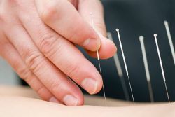  What Ailments can be cured with Acupuncture?